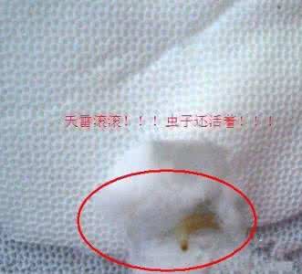 卫生巾里有虫子 卫生巾虫子 卫生巾里有虫子