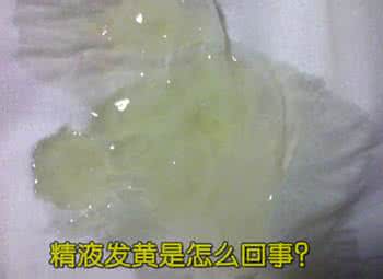 男性眉毛稀少 导致男性精液发黄变稀的原因