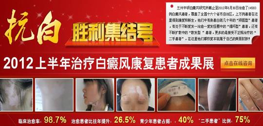 商场同款 商场同款省心更省钱 治疗白癜风的方法 牢记这些治疗白癜风更省钱