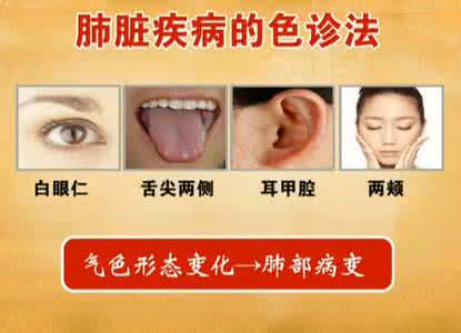 龟头炎种类及症状图片 肺病的症状 肺病症状及种类都有哪些
