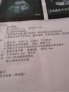 双顶径计算胎儿体重 37周胎儿双顶径计算胎儿体重