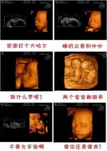 产检大排畸注意事项 大排畸注意事项