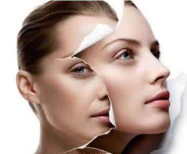 祛斑美白的方法 夏季美白祛斑的4个误区