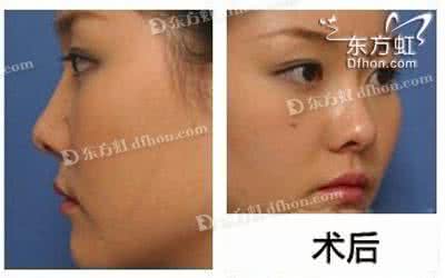 哪里能去除疤痕 哪里能去除疤痕 怎样去疤痕