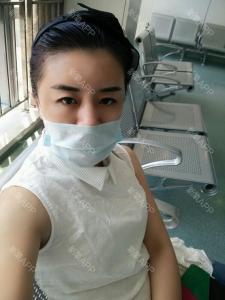 自体脂肪填充额头手术 做额头脂肪填充术 解析额部填充术