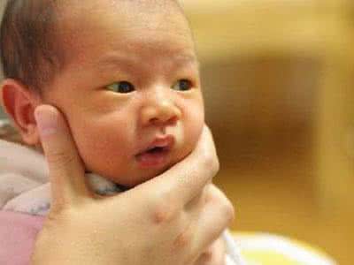 黄疸病 黄疸病 患上这种病怎么办