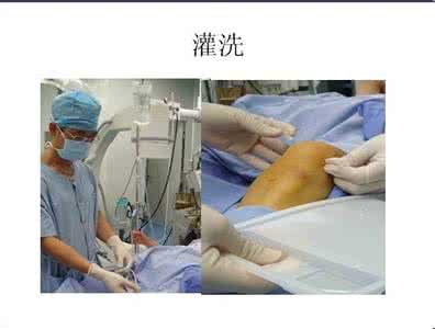 骨性关节炎治疗方法 骨性关节炎治疗方法 怎样治疗骨性关节炎 5个方法治疗骨性关节炎