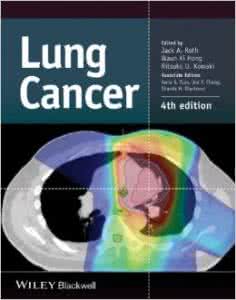 lung cancer lung cancer Lung Cancer Risk in White and Black Americans