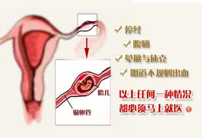 中风的症状与急救措施 宫外孕有哪些症状 宫外孕急救措施