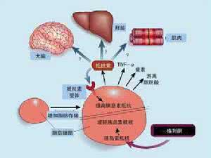 代谢综合征治疗 代谢综合征 代谢综合征如何治疗