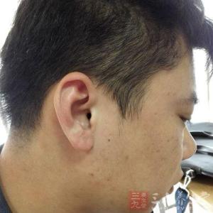 怎么掏耳朵深处的耳屎 看耳朵这处竟能知道你的财运