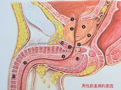 尿道口有痒前列腺炎 尿道口有点痒 导致尿道口有点痒的原因