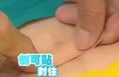 肚脐祛湿 肚脐上放一物, 活血祛湿减少便秘 ,体重少20斤!