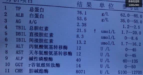 间接胆红素偏高怎么办 胆红素高 胆红素高应该怎么办