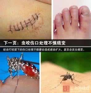 伤口缝线的地方硬硬的 20年前这地方有伤口竟会变成癌症