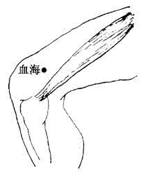 月经先期的原因 月经先期的刮痧疗法