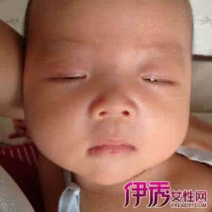 脑积水的原因 脑积水的原因 脑积水的原因 脑积水从何而来