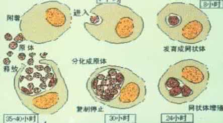 怎么治疗支原体效果好 支原体感染怎么治疗 这样治疗效果好