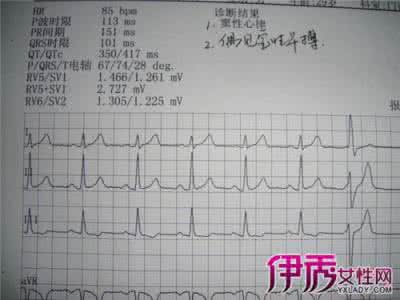 倍他乐克治疗早搏 19岁女生偶发室上性早搏可以吃倍他乐克吗