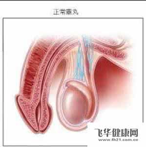 尿道口发红咋回事 男孩尿道口发红的常见原因有哪些
