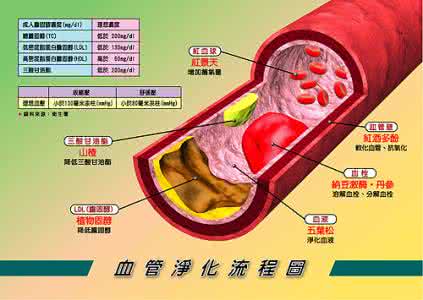 清理血管壁干净的药方 清理血管壁的验方