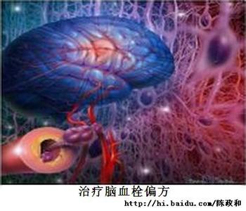 治疗风痰阻络症代茶饮 脑血栓方（二）治疗风痰阻络型脑血栓形成