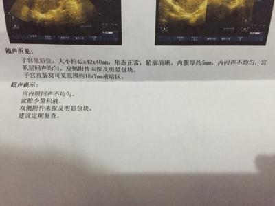 b超是检查什么的 b超检查什么的 B超检查什么