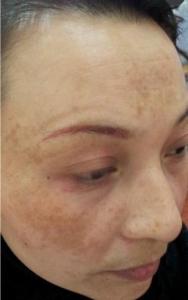 老中医说只用清水洗脸 老中医一句话：洗脸加一“物”让斑点10天消失皮肤水嫩