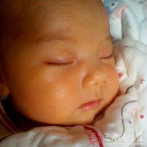 新生儿黄疸如何治疗 新生儿黄疸如何治疗 新生儿黄疸如何防治