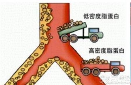 高胆固醇血症能治好吗 高胆固醇血症能治好吗 胆固醇高能治好吗？