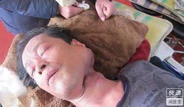 恶性淋巴瘤 腹痛呕吐未必是胃病 也可能是恶性淋巴瘤