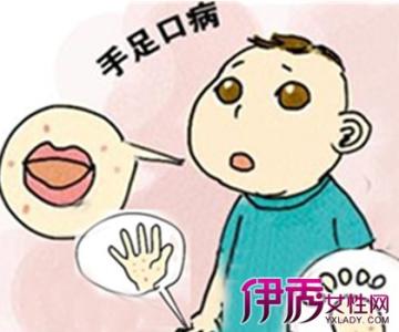 手足口病传染大人吗 手足口病传染大人吗 手足口病如何传染?