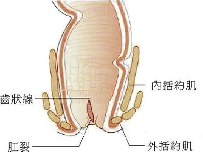 肛门疾病 肛门疾病良方