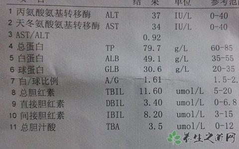 肝功能检查的项目 肝功能检查项目有哪些