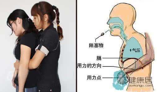 老人噎食时的急救措施 噎食现场急救怎么做