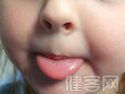 男生吐舌头是性暗示 舌头出现这症状暗示身体出现异常