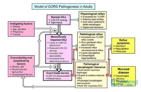 胃食管反流病中医治疗 胃食管反流病的中医研究进展