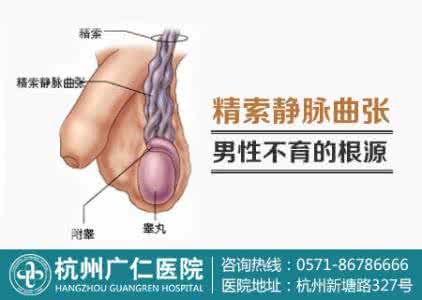 静脉曲张的注意事项 静脉曲张的原因 静脉曲张注意事项