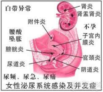 前列腺炎传染女性吗 前列腺炎传染女性吗？