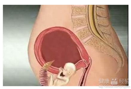 宫外孕还能再生孩子吗 宫外孕 宫外孕还能生孩子吗