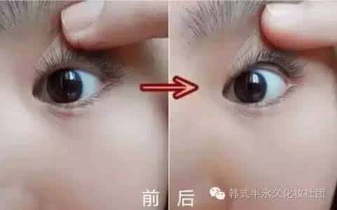 做美瞳线后要注意什么 做美瞳线后要注意什么 近期做了美瞳线的注意啦……
