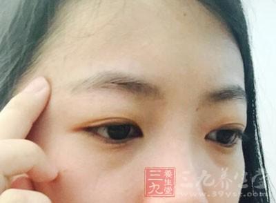 脑垂体瘤的早期症状 脑垂体瘤的早期症状 垂体瘤的症状 不孕的女人这里竟能流出水