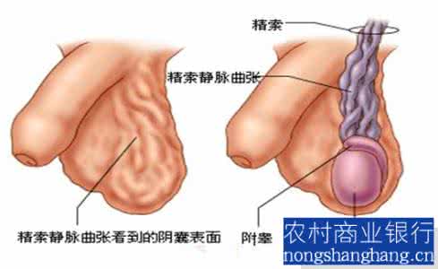 睾丸小会不会影响生育 睾丸小会不会影响生育 睾丸受到损伤会不会影响生育?