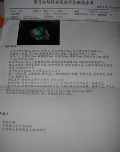 大排畸检查的最佳时间 大排畸检查的方式