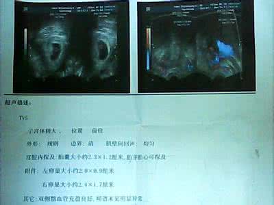 b超女孩生下来男孩 b超男孩生下来是女孩 b超数据显示男孩 生下来竟让所有人都大吃一惊
