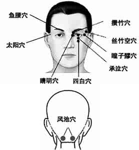 缓解飞蚊症 按穴位缓解飞蚊症(祝您健康)