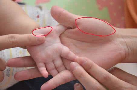 人参健脾丸 孩子手上两个健脾穴，没事儿揉揉好处多