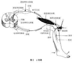 痉挛性麻痹 柔软性麻痹 痉挛性麻痹