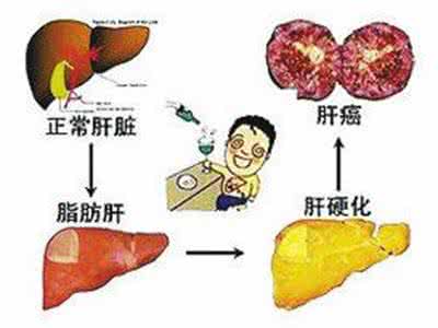 乙肝复发症状 乙肝复发的五大诱因