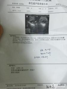 孕妇为什么会宫腔积血 什么是宫腔积血